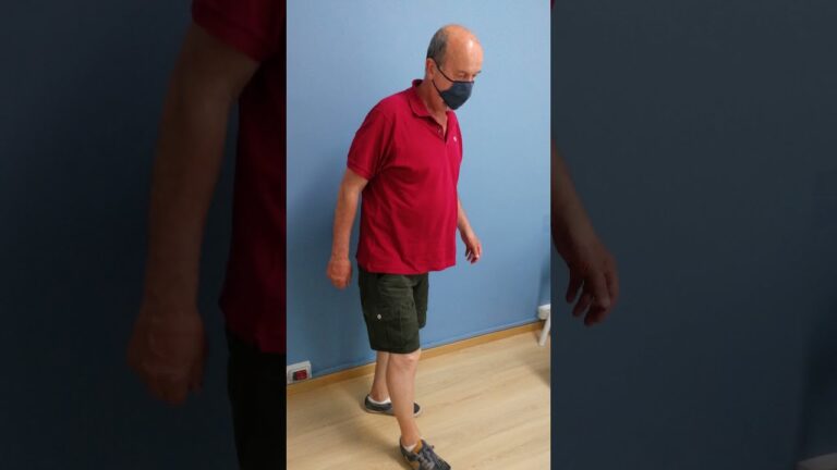 Riduci il dolore al ginocchio: scopri i tempi di recupero dell&#8217;osteotomia tibiale valgizzante